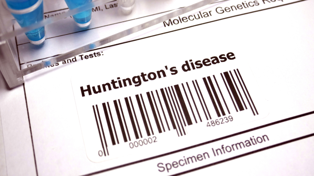 Tratamiento para la enfermedad de Huntington