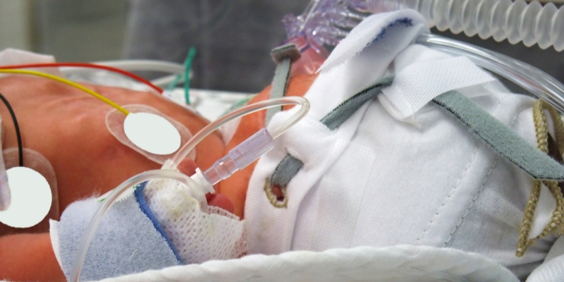 Corazón artificial mantiene con vida a un bebé