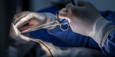¿Qué responsabilidad tiene el doctor por la rotura de material quirúrgico en una intervención?